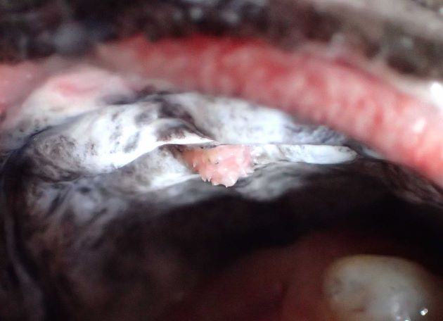 鋤骨（上顎内天井部分）に歯塊があり、円形。