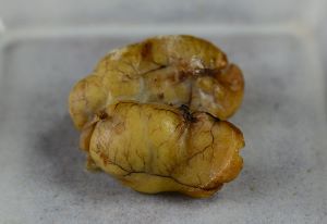 クリックで拡大表示