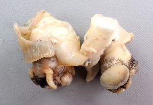 クリックで拡大表示